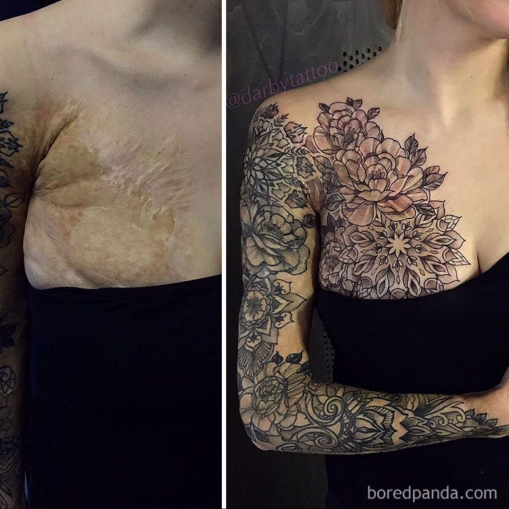 Tattoos Have the Capability To Cover Up Birthmarks And Scars On The Skin Making Them Disappear