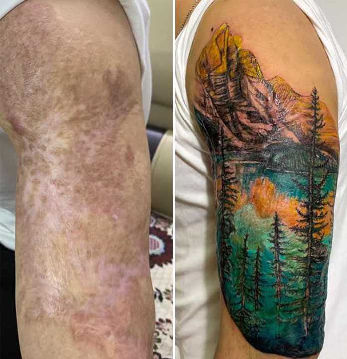 Are You Trying To Cover Up Your Scars? This Tattoo Artist Can Do It For Sure!