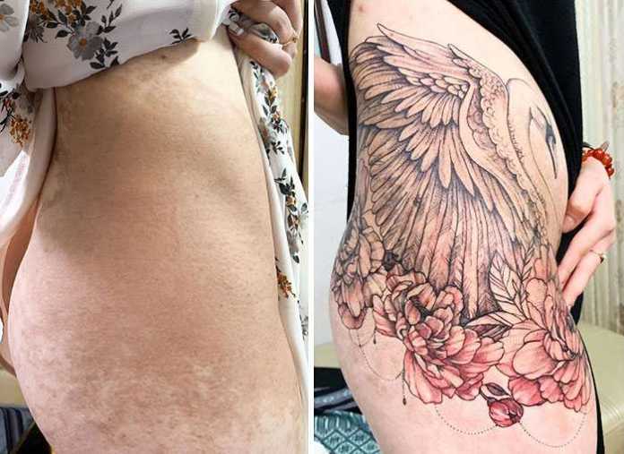 Are You Trying To Cover Up Your Scars? This Tattoo Artist Can Do It For Sure!