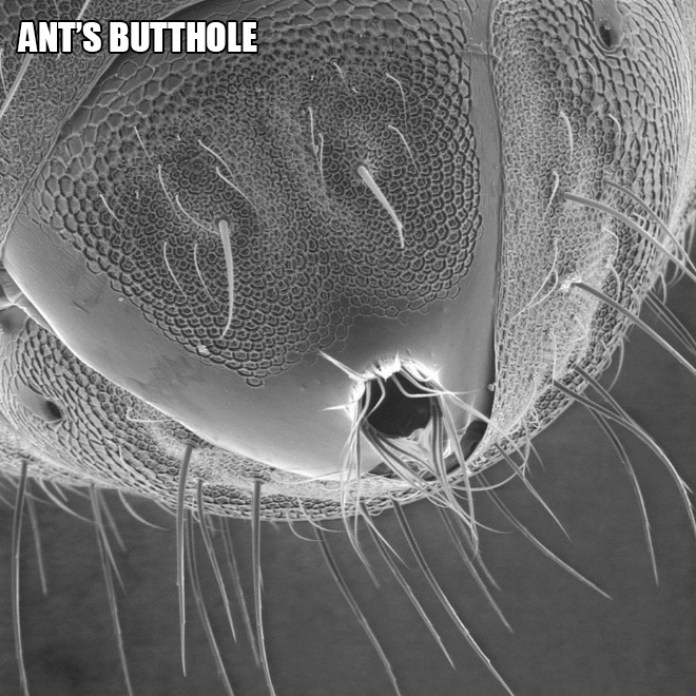Insects With Scariest look Under The Microscope